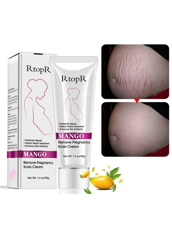 2 Pack Remove Pregnancy Scars Acne Cream Stretch Marks Treatment Maternity Repair Anti-Aging Anti Winkles Firming Body Creams