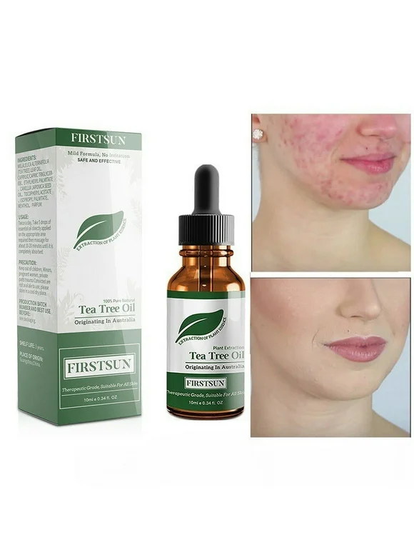 Tea Tree Pure EssentialOil FaceCare Skin Acne Blackhead Remover Anti Scar Spots Facial
